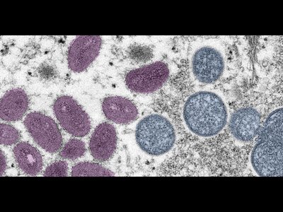 Monkeypox vaccine now available at Baldwin County Health Department